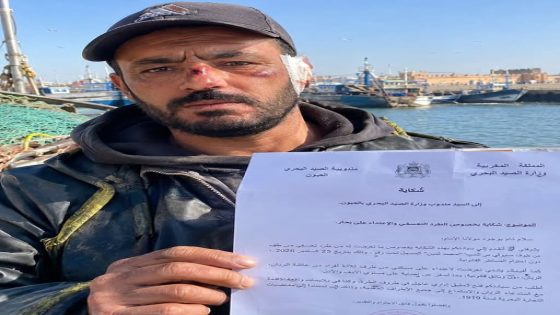 العيون | شكاية إلى مندوبية الصيد البحري بشأن طرد بحّار وادعاء تعرضه للاعتداء
